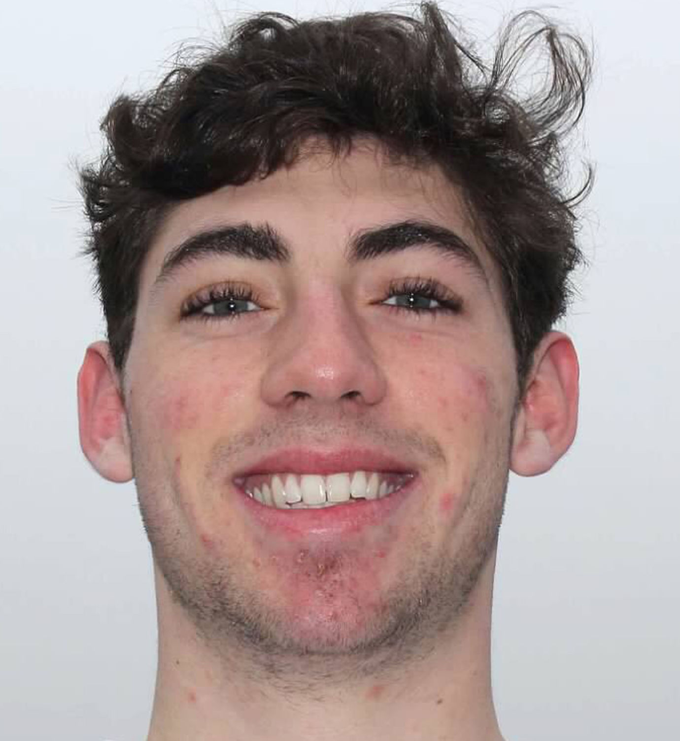 Thomas Niedringhaus, MICDS
